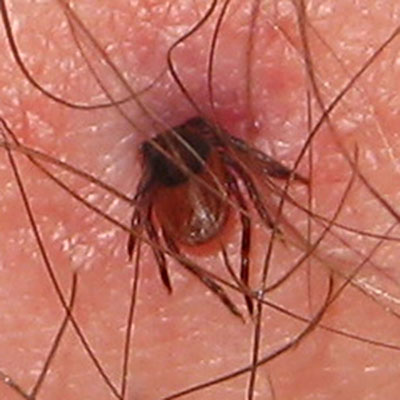 Ixodes pacificus - The Western Black-legged Tick